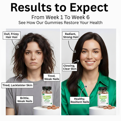 Revare Multi-Vitamin Gummies